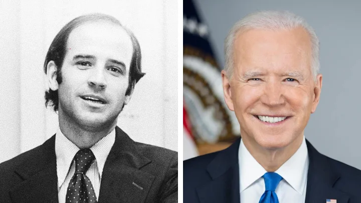 Joe Biden Hair Transplant